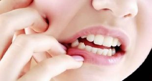 Penyebab Gigi Ngilu Tiba Tiba dan Berkepanjangan, Solusi, dan Tips Merawat Gigi Sensitif
